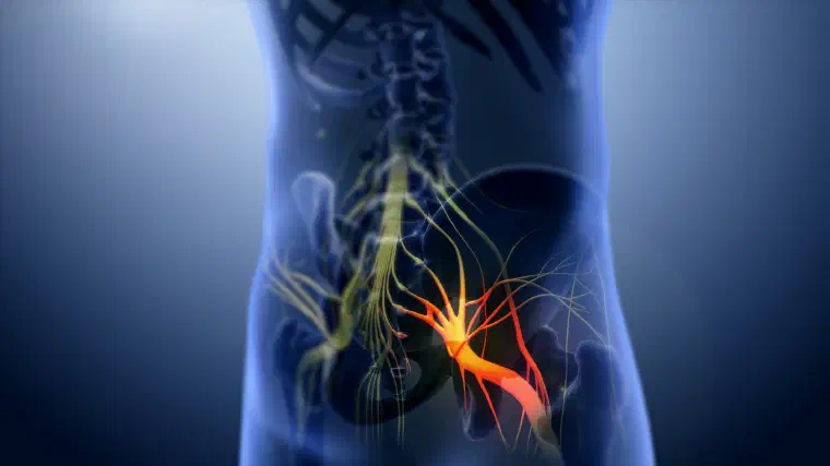 3D medical visualization of the sciatic nerve pathway